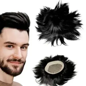 Hair Patches